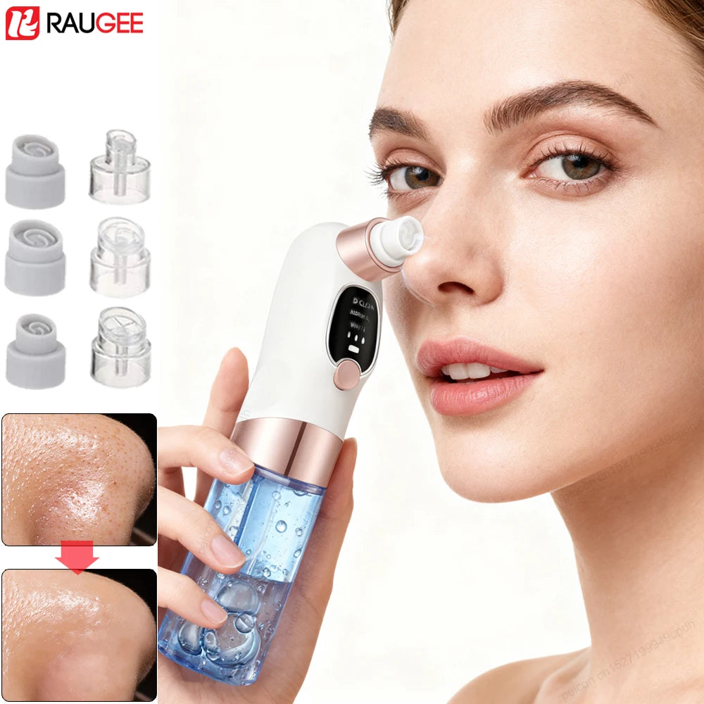 Micro Bubble Blackhead Remover