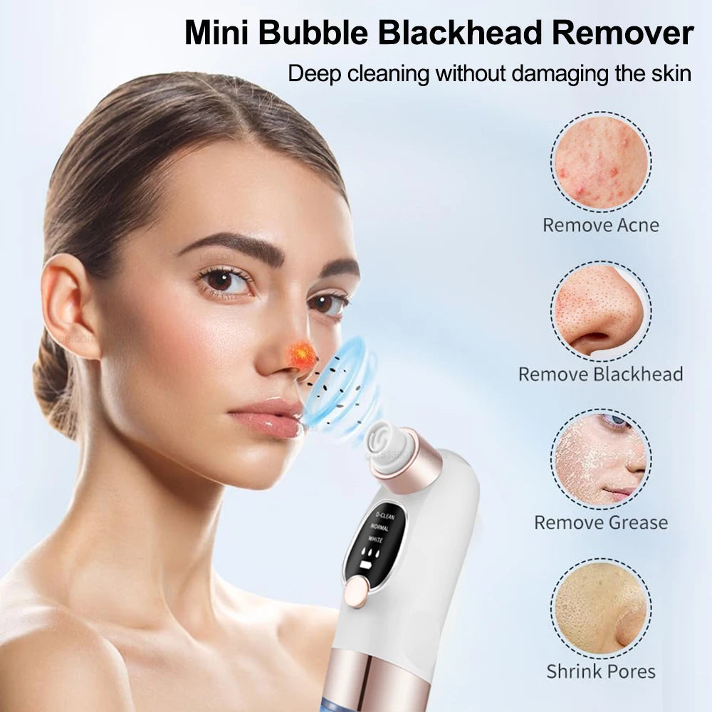 Micro Bubble Blackhead Remover